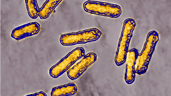 Hình ảnh: Hàng chục ca nhiễm khuẩn Listeria phải nhập viện tại Mỹ số 1